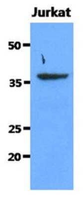 Western Blot: Sorbitol Dehydrogenase Antibody (10F4)BSA Free [NBP2-42653]