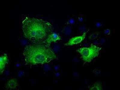 Immunocytochemistry/ Immunofluorescence: Sorbitol Dehydrogenase Antibody (OTI9E7) [NBP2-02126]