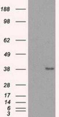 Western Blot: Sorbitol Dehydrogenase Antibody (OTI9E7) [NBP2-02126]