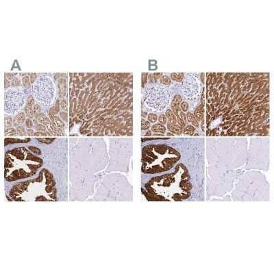 Immunohistochemistry-Paraffin: Sorbitol Dehydrogenase Antibody [NBP1-87415]