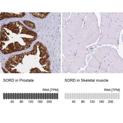 Immunohistochemistry-Paraffin: Sorbitol Dehydrogenase Antibody [NBP1-87415]