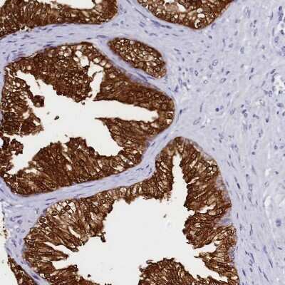 Immunohistochemistry-Paraffin: Sorbitol Dehydrogenase Antibody [NBP1-87415]