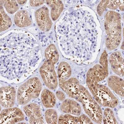Immunohistochemistry-Paraffin: Sorbitol Dehydrogenase Antibody [NBP1-87415]