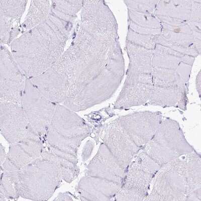Immunohistochemistry-Paraffin: Sorbitol Dehydrogenase Antibody [NBP1-87415]