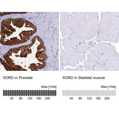 Immunohistochemistry-Paraffin: Sorbitol Dehydrogenase Antibody [NBP1-87416]