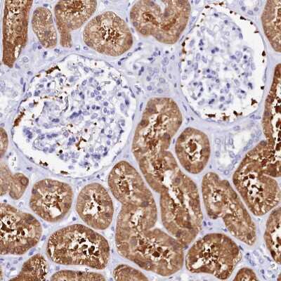 Immunohistochemistry-Paraffin: Sorbitol Dehydrogenase Antibody [NBP1-87416]
