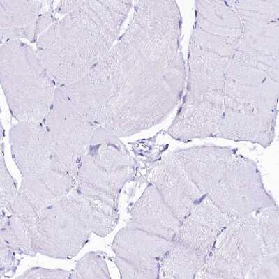 Immunohistochemistry-Paraffin: Sorbitol Dehydrogenase Antibody [NBP1-87416]