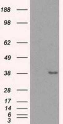 Western Blot: Sorbitol Dehydrogenase Antibody (OTI9E7)Azide and BSA Free [NBP2-74288]