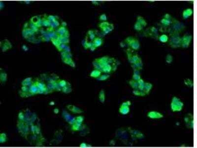 Immunocytochemistry/ Immunofluorescence: Sorbitol Dehydrogenase Antibody (OTI9E7) [NBP2-02126]