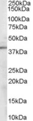 Western Blot: Sorbitol Dehydrogenase Antibody [NB100-1486]