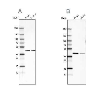 Western Blot: Sorbitol Dehydrogenase Antibody [NBP1-87415]