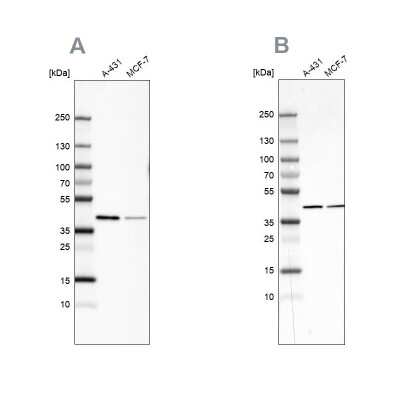 Western Blot: Sorbitol Dehydrogenase Antibody [NBP1-87416]