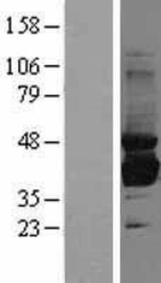 Western Blot: Sorbitol Dehydrogenase Overexpression Lysate [NBL1-16339]