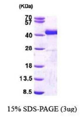 SDS-PAGE: Recombinant Human Sorbitol Dehydrogenase His Protein [NBP1-44460]