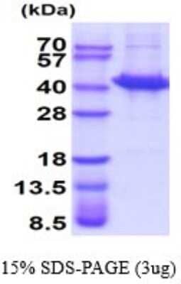 SDS-PAGE: Recombinant Human Sorbitol Dehydrogenase Protein [NBP2-52293]