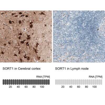 Immunohistochemistry-Paraffin: Sortilin Antibody (CL6526) [NBP2-76498]