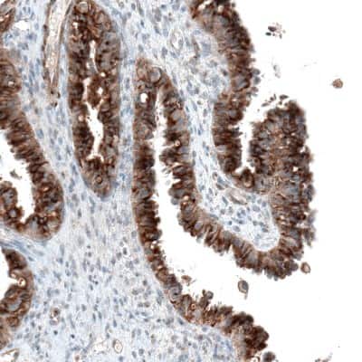 Immunohistochemistry-Paraffin: Sortilin Antibody (CL6526) [NBP2-76498]