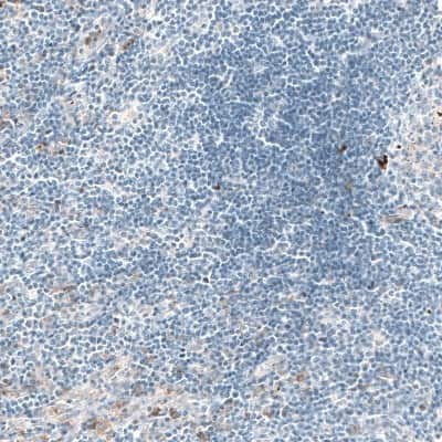 Immunohistochemistry-Paraffin: Sortilin Antibody (CL6526) [NBP2-76498]