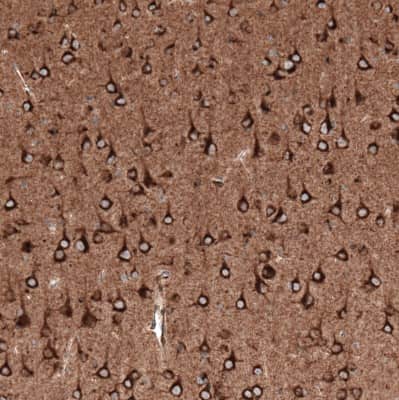 Immunohistochemistry-Paraffin: Sortilin Antibody (CL6526) [NBP2-76498]