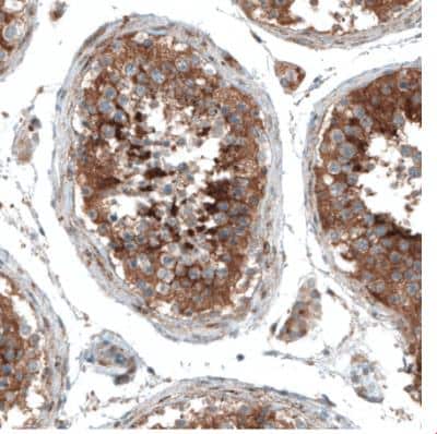 Immunohistochemistry-Paraffin: Sortilin Antibody (CL6526) [NBP2-76498]