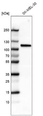 Western Blot: Sortilin Antibody (CL6526) [NBP2-76498]