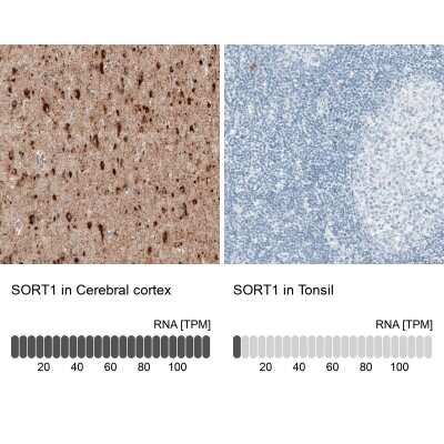 Immunohistochemistry-Paraffin: Sortilin Antibody (CL6528) [NBP2-76501]