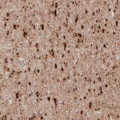 Immunohistochemistry-Paraffin: Sortilin Antibody (CL6528) [NBP2-76501]