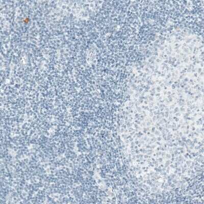 Immunohistochemistry-Paraffin: Sortilin Antibody (CL6528) [NBP2-76501]