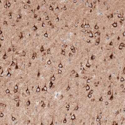 Immunohistochemistry-Paraffin: Sortilin Antibody (CL6528) [NBP2-76501]