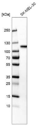 Western Blot: Sortilin Antibody (CL6528) [NBP2-76501]