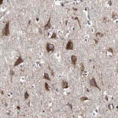 Immunohistochemistry-Paraffin: Sortilin Antibody [NBP1-89745]