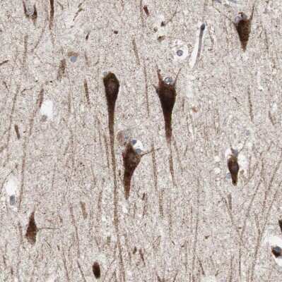 Immunohistochemistry-Paraffin: Sortilin Antibody [NBP1-89745]