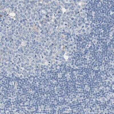 Immunohistochemistry-Paraffin: Sortilin Antibody [NBP1-89745]