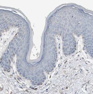 Immunohistochemistry-Paraffin: Sortilin Antibody [NBP1-89745]