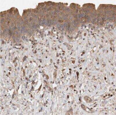Immunohistochemistry-Paraffin: Sorting Nexin 31 Antibody [NBP1-92423]