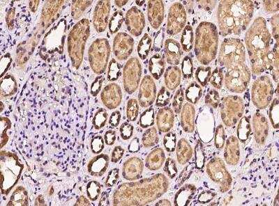 Immunohistochemistry-Paraffin: Sorting Nexin 31 Antibody [NBP3-06489]