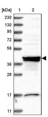 Western Blot: Sorting Nexin 31 Antibody [NBP1-92423]