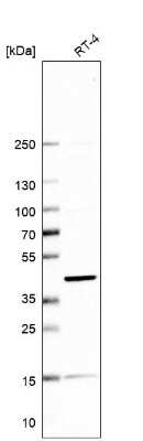 Western Blot: Sorting Nexin 31 Antibody [NBP1-92423]