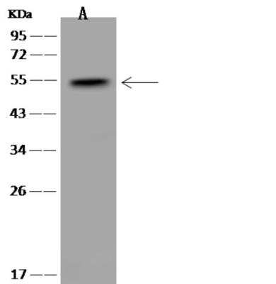 Western Blot: Sorting Nexin 31 Antibody [NBP3-06489]