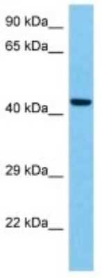 Western Blot: Sorting Nexin 31 Antibody [NBP3-10155]