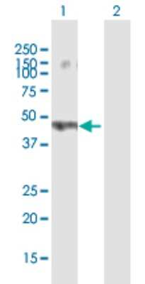 Western Blot: Sorting Nexin 32 Antibody [H00254122-B01P]