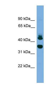 Western Blot: Sorting Nexin 32 Antibody [NBP1-79591]