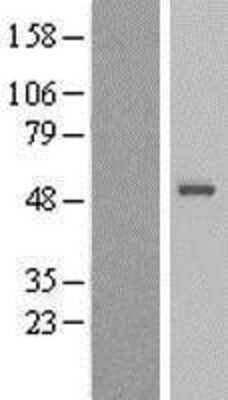 Western Blot: Sorting Nexin 32 Overexpression Lysate [NBL1-16315]