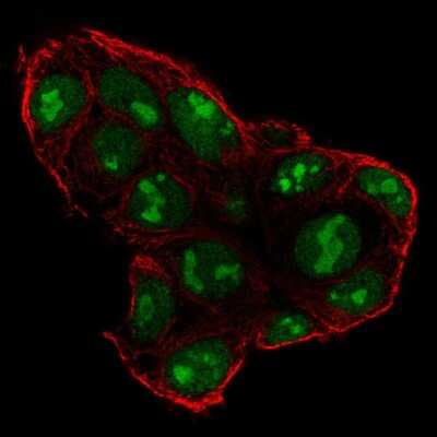 Immunocytochemistry/ Immunofluorescence: Sp5 Antibody [NBP2-56340]