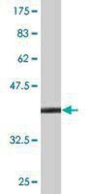 Western Blot: TFF2 Antibody (2A10) [H00007032-M01]