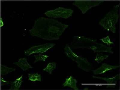 Immunocytochemistry/ Immunofluorescence: Spastin Antibody (2F5) [H00006683-M02]