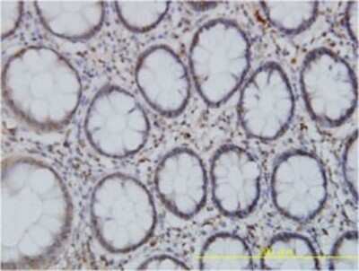 Immunohistochemistry-Paraffin: Spastin Antibody (2F5) [H00006683-M02]
