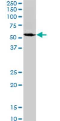 Western Blot: Spastin Antibody (2F5) [H00006683-M02]