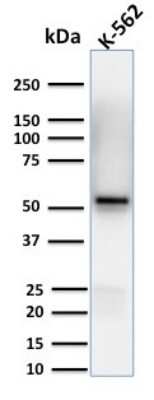 Western Blot: Spastin Antibody (Sp 6C6)Azide and BSA Free [NBP3-08753]