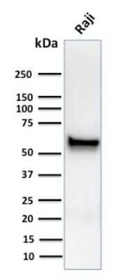 Western Blot: Spastin Antibody (Sp 6C6) [NBP3-07842]